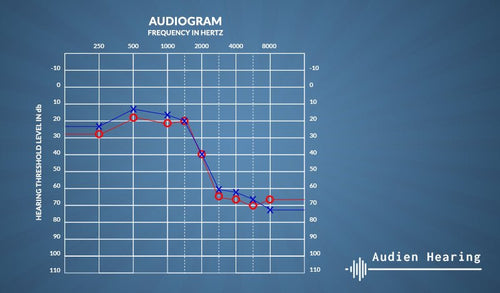 Will Audien Hearing Aids Work For Me?